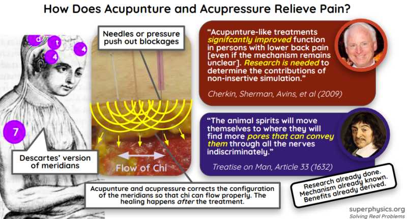 Acupuncture