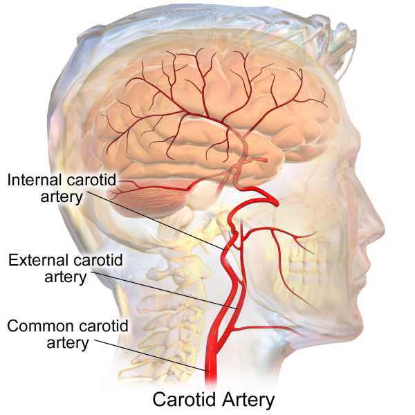 Carotid arteries